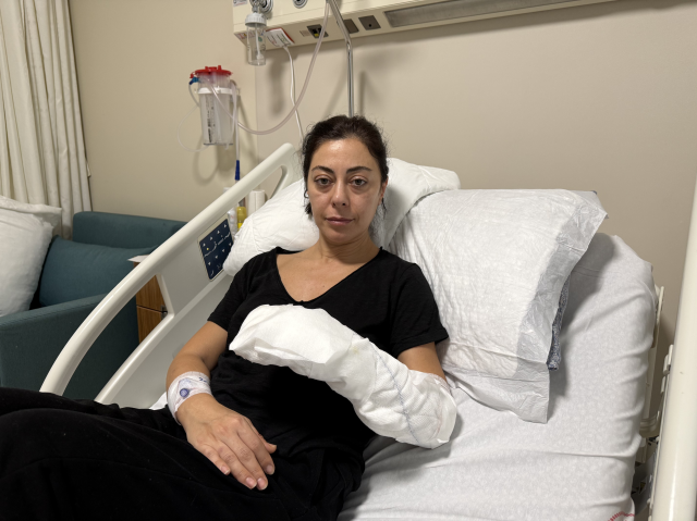 The decorative fireplace exploded like a bomb, 30% of her body was burned