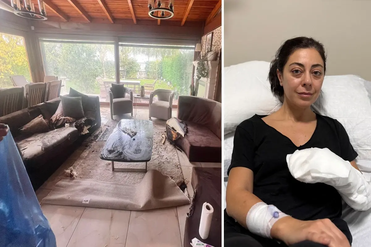 Sakın evinize sokmayın! Dekoratif olarak aldı, vücudunun yüzde 30'u yandı