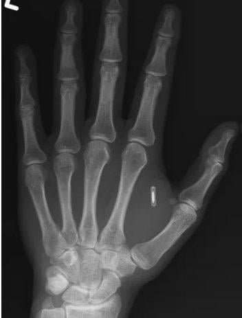 akilalmaz hata eline yerlesltirdigi mikrocipin 19312644 402 m