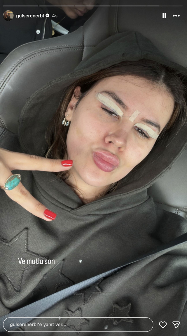 Her marriage to Mehmet Ali Erbil was widely discussed! Gülseren Ceylan had her eyelids done