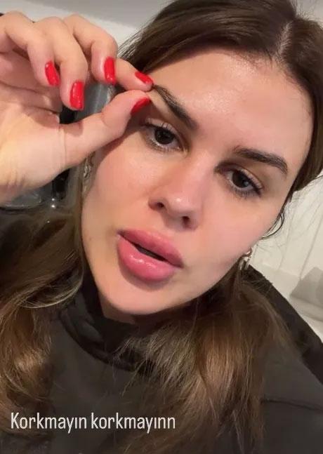 ازدواج گلسرن جیلان با محمد علی‌اربیل بسیار مورد بحث قرار گرفت! او جراحی پلک انجام داد