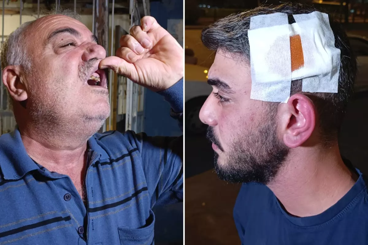 Komşu dehşeti! Babanın dişlerini kırdı, anneyle oğlunu bıçakladı