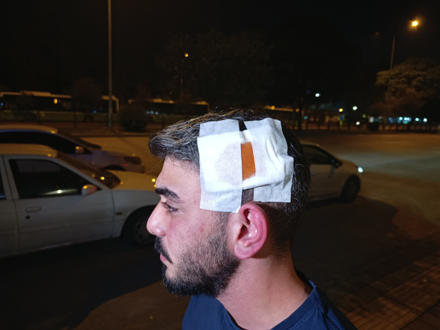 Neighbor horror! Broke the father's teeth, stabbed the mother and son