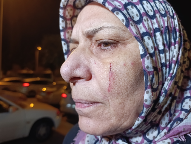 Neighbor horror! Broke the father's teeth, stabbed the mother and son