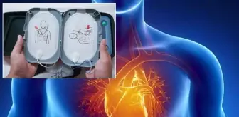 Kalp hastalarının vazgeçilmezi! Artık yerli üretim, ilk orada hizmete alındı