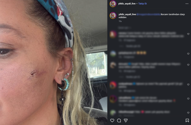 Darp iddiası gündemdeydi! Yıldız Asyalı yaşadıklarını tek tek anlattı! Eşinden ilk açıklama geldi Darp iddiası gündemdeydi! Yıldız Asyalı yaşadıklarını tek tek anlattı! Eşinden ilk açıklama geldi