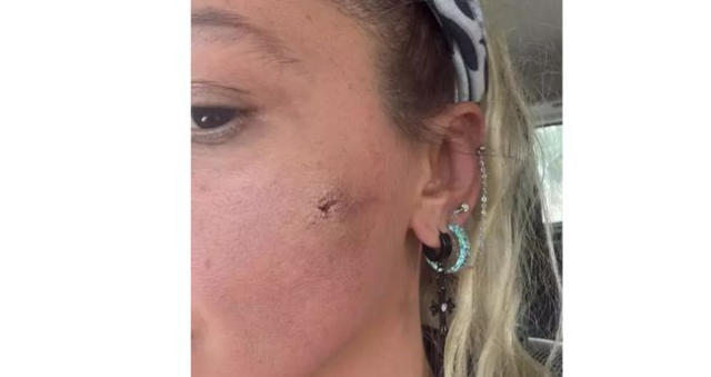 Yıldız Asyalı eşi Mustafa Semih Demirci'den şiddet mi gördü? Yıldız Asyalı kocasından şiddet mi gördü? Yıldız Asyalı eşi Mustafa Semih Demirci'den şiddet mi gördü? Yıldız Asyalı kocasından şiddet mi gördü?