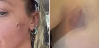 Yıldız Asyalı eşi Mustafa Semih Demirci'den şiddet mi gördü? Yıldız Asyalı kocasından şiddet mi gördü?