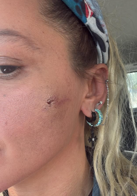 yildiz asyali kocasindan siddet gordugunu acikladi 19337201 4334 m