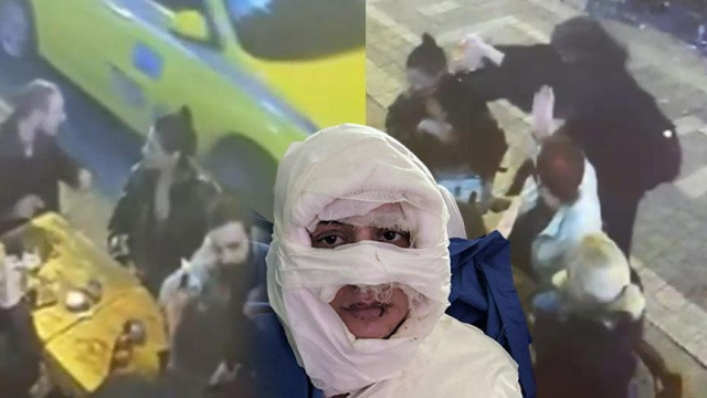 kadikoy de genc kadini yanici madde dokup yakarak 19341720 8470 m