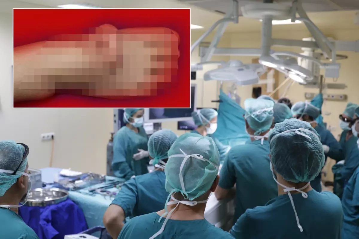 Eşi benzeri olmayan olay! Kulağını 5 ay ayağında taşıdı