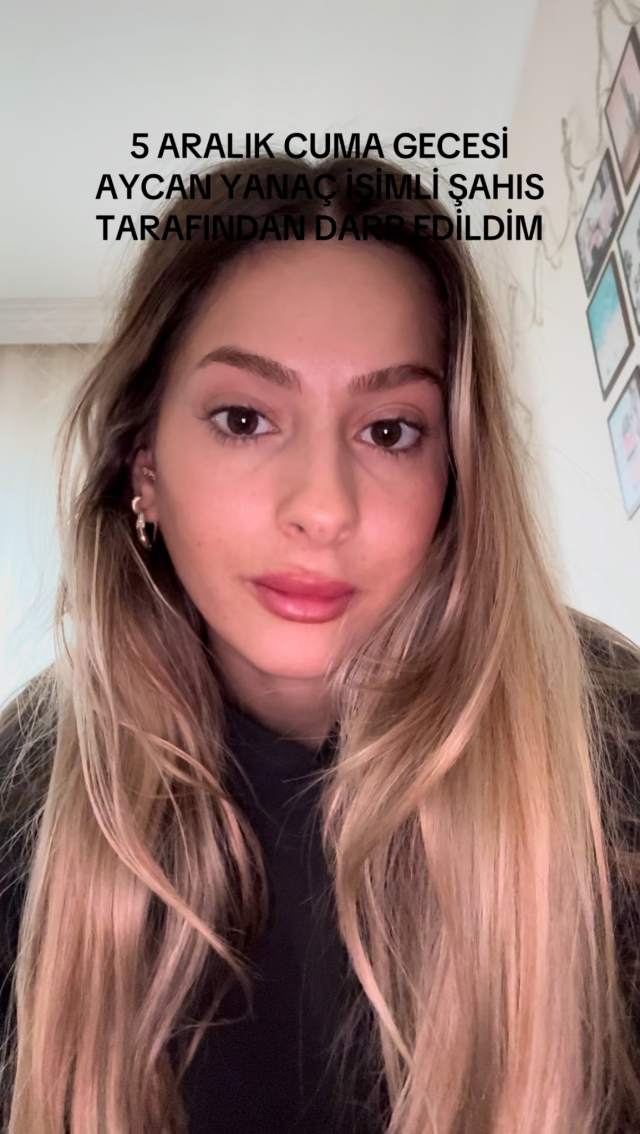 Survivor Aycan Yanaç'ın eğlence mekanında kadını darp ettiği iddiası: Suratıma vurdu saçımı tutup yere yatırdı Survivor Aycan Yanaç'ın eğlence mekanında kadını darp ettiği iddiası: Suratıma vurdu saçımı tutup yere yatırdı