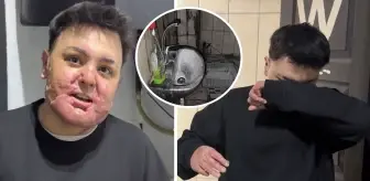 65 ameliyat geçirdi, 12 gün uyutuldu! Hayatı saniyeler içinde kabusa döndü