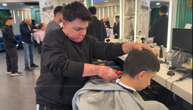 65 ameliyat geçirdi, 12 gün uyutuldu! Hayatı saniyeler içinde kabusa döndü 4 65 ameliyat gecirdi 12 gun uyutuldu hayati 19357379 6944 m