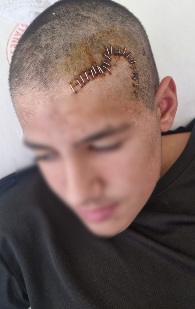 akran zorbaligina maruz kalan 13 yasindaki 19371407 3717 m