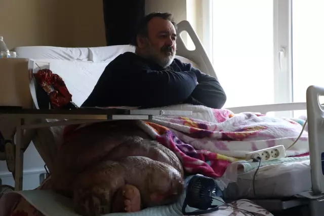 لم أتمكن من الخروج من المنزل منذ 5 سنوات! وزني زاد لدرجة أن حياتي أصبحت جحيماً