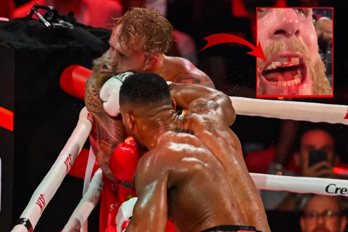 Anthony Joshua, Jake Paul'un çenesini kırdı