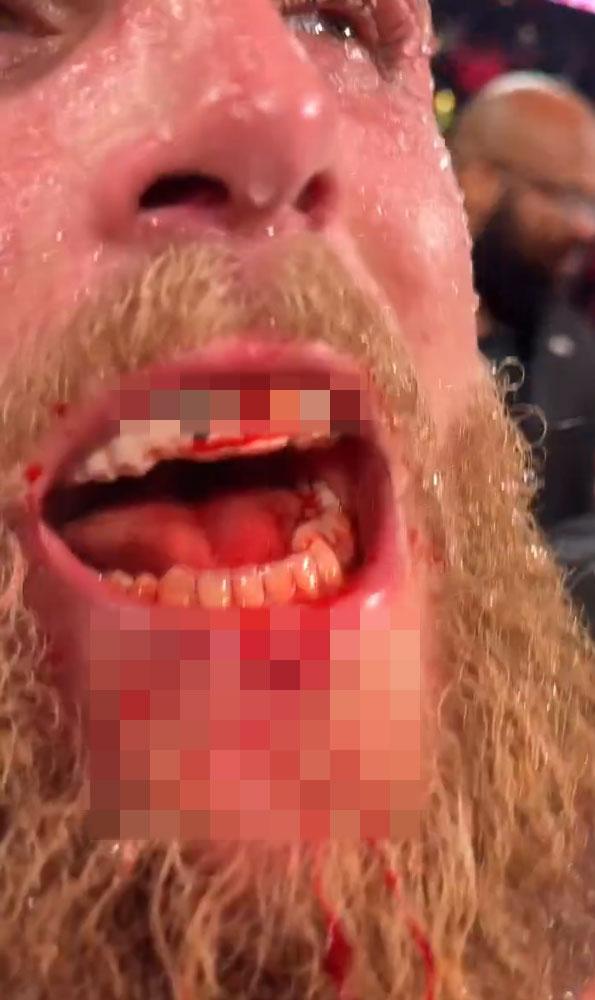 anthony joshua jake paul un cenesini kirdi 19373618 1522 m