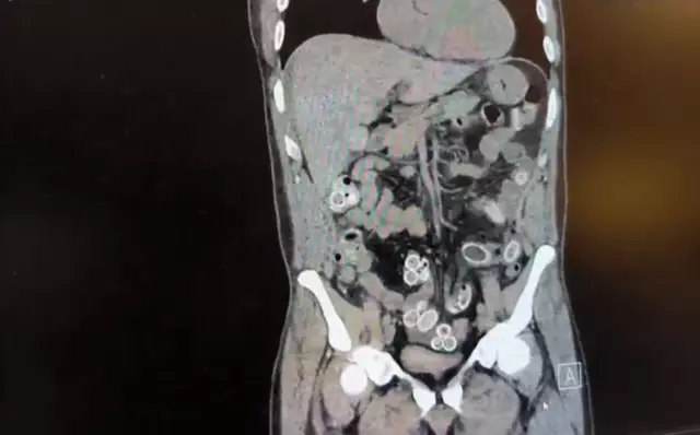 fas tan besiktas a midesinde uyusturucu getir 19378953 o