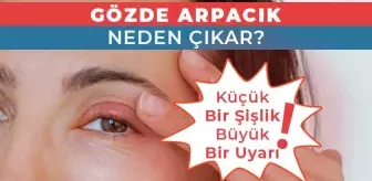 Gözde Arpacık Neden Çıkar? Küçük Bir Şişlik, Büyük Bir Uyarı