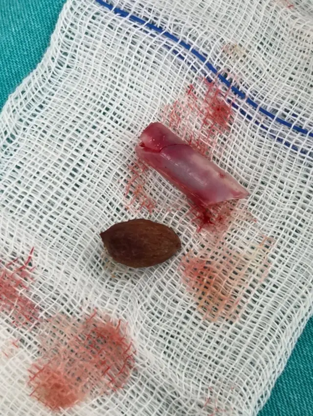 kasinti sikayetiyle hastaneye giden emirhan i 2 19396499 o