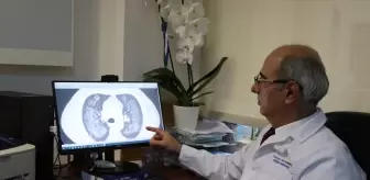 Elektronik sigaranın akciğerde yol açtığı hasar yoğun bakımla sonuçlanıyor