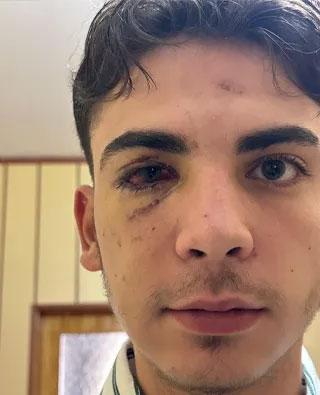 ضربوه بالعصي حتى فقد بصره، وصوروا فيديو بيدين ملطختين بالدم! المشتبه بهم الذين تم الإفراج عنهم بعد 1.5 شهر تم اعتقالهم مرة أخرى