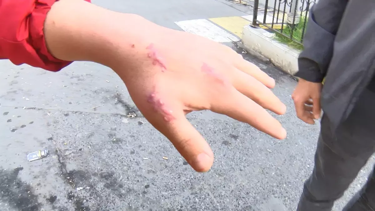 Kedi elini ısırınca hastaneye gitti, parmağındaki tendonun koptuğu iddiasıyla doktordan şikayetçi oldu