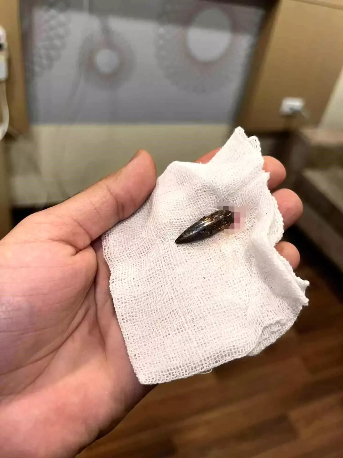 Gazzeli Awad, 1,5 yıldır kafasında taşıdığı mermiden Türk yardımseverlerin desteğiyle kurtuldu