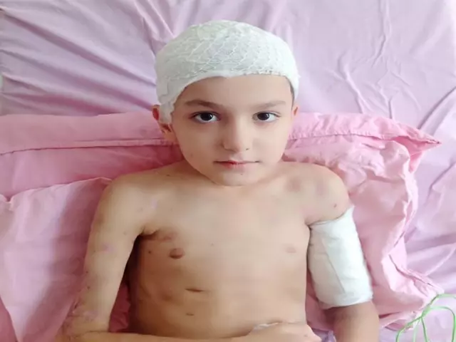 sokak kopeklerinin saldirisinda yaralanan tun 4 19442872 o