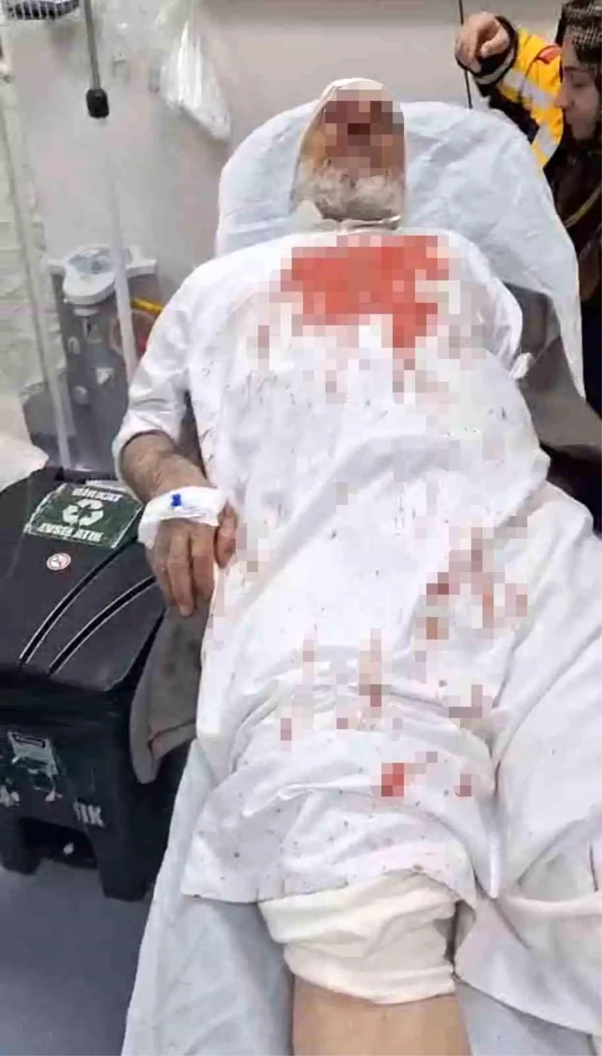 Şanlıurfa'da 72 yaşındaki adamı öldüresiye döven 4 şüpheli tutuklandı