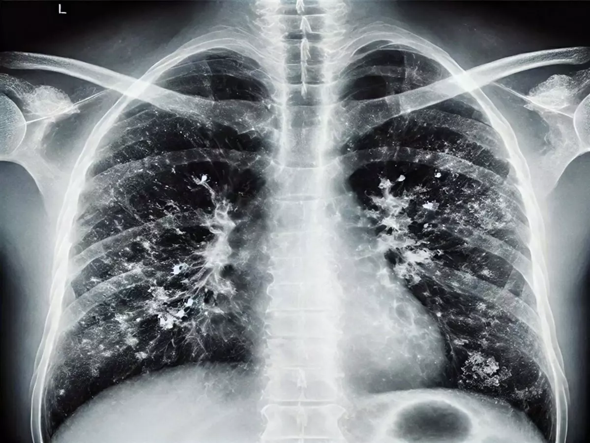 'Kışın solunum yolu enfeksiyonlarında artış doğal, hijyen şart'