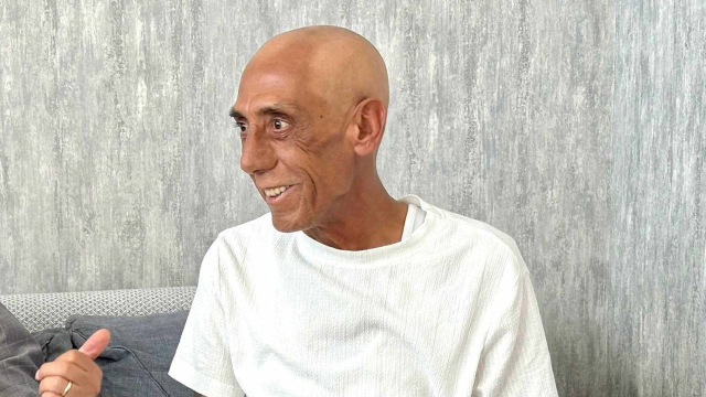 ankarali turgut un miras davasi sonuclandi 19471184 6765 m