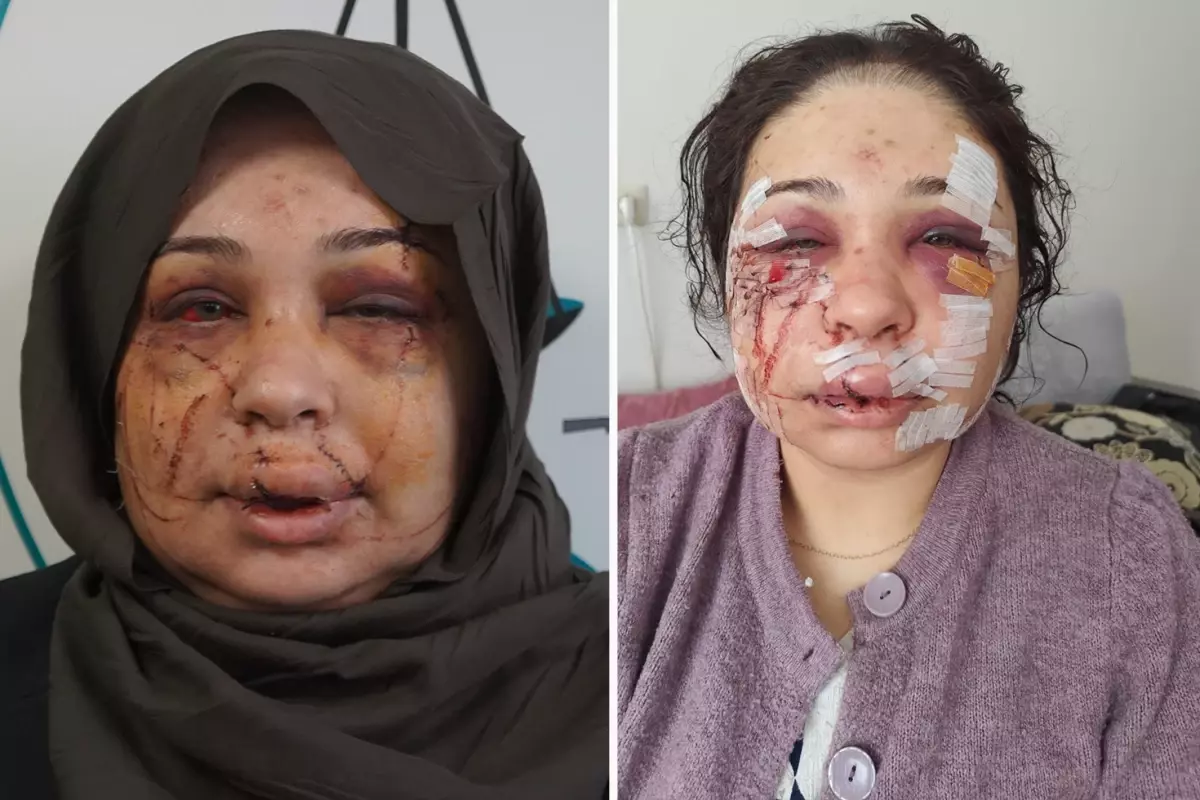 Polis eşi tarafından darbedildiği iddiasıyla şikayetçi oldu