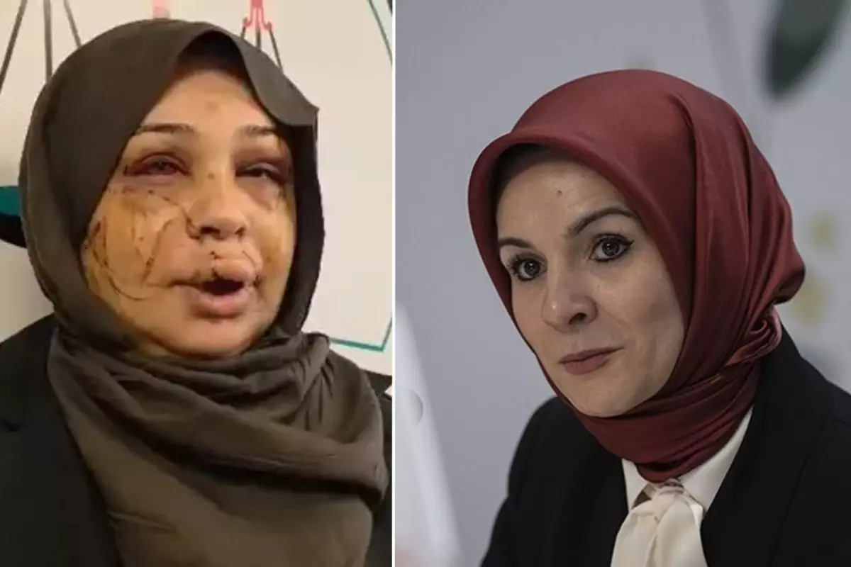 Bakan Göktaş: Şiddete uğrayan kardeşimizin yanındayız, davaya müdahil olacağız