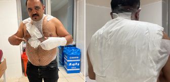 Deney yapmak isterken hayatının hatasını yaptı