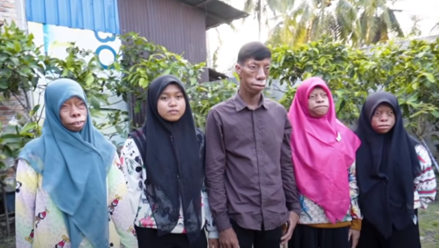 The world is talking about them! The 'Lizard Family' quickly became a phenomenon