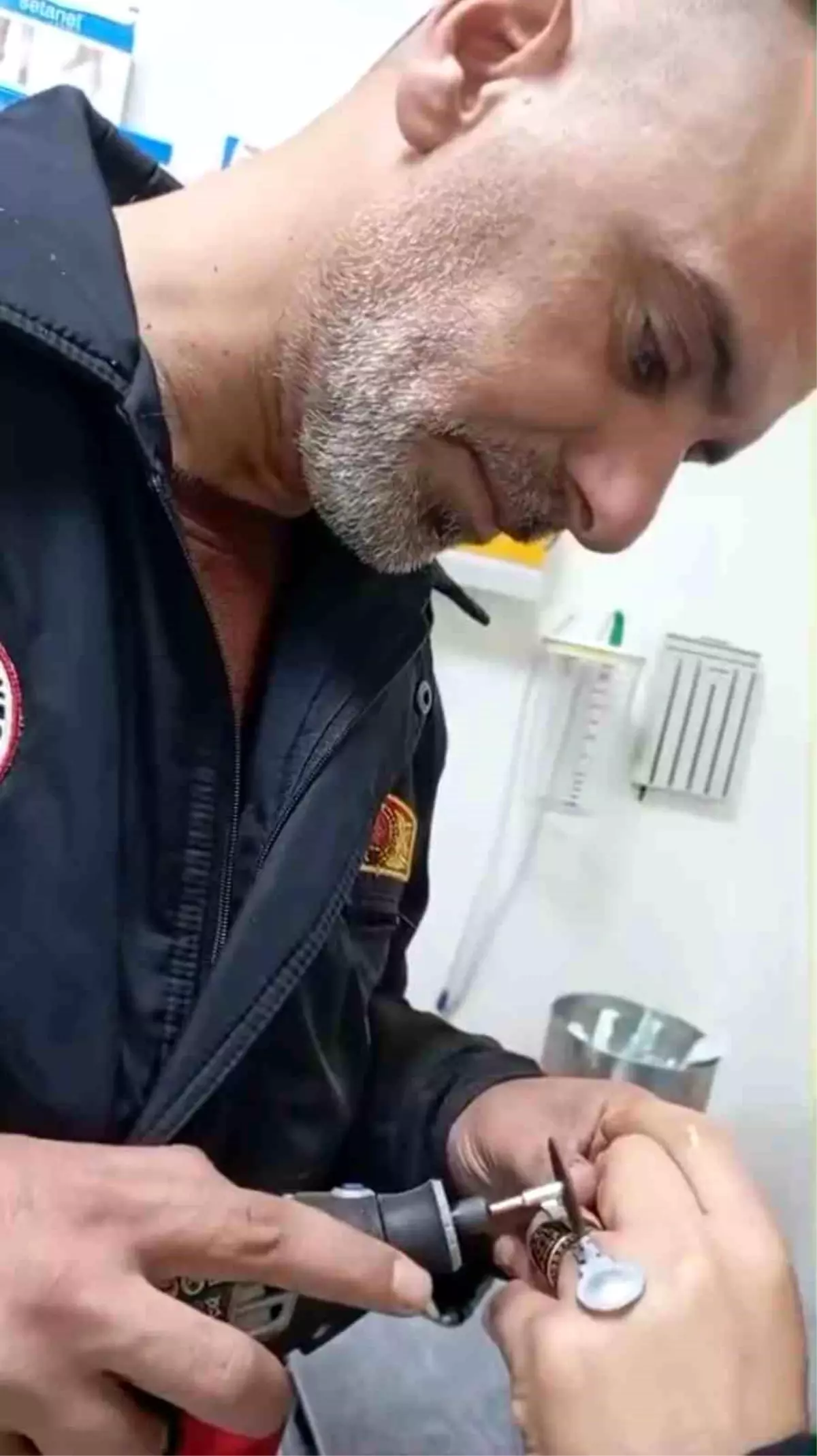 Sıkışan yüzük itfaiye ekiplerince çıkarıldı