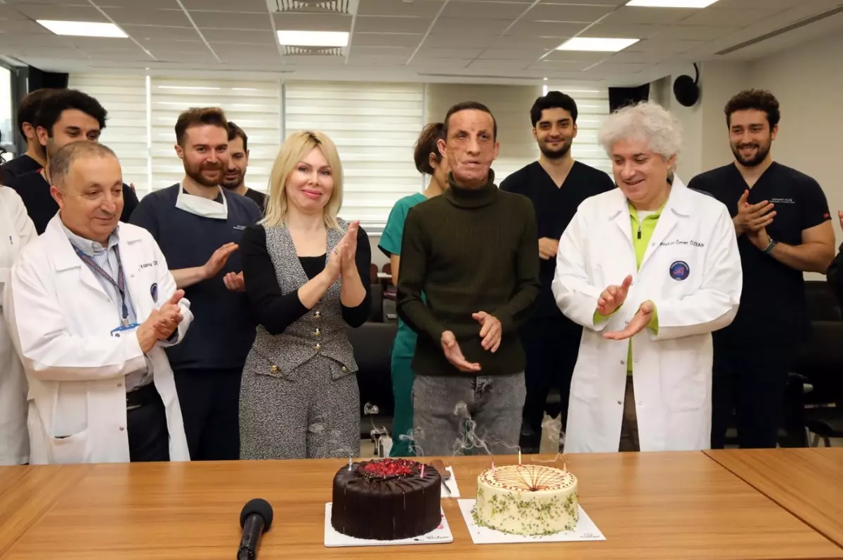 İlk yüz nakilli Uğur Acar, hayata 14 yıldır başka bir yüzle bakıyor