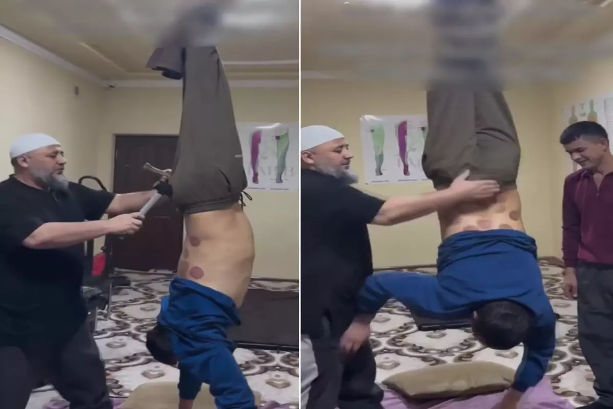 Tedavi değil işkence! Ayaklarından tavana asıp çekiç ve kazıkla...