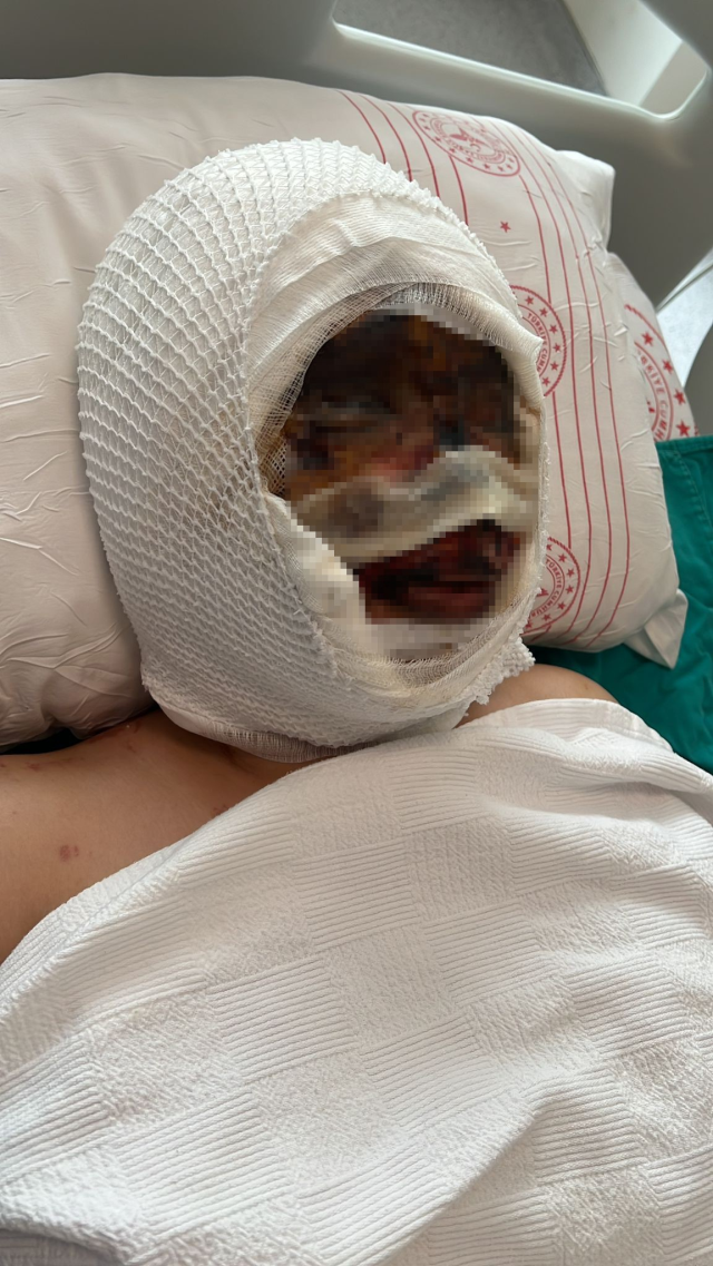 Bunun adı saf kötülük! Eşini koli bandıyla bağlayıp kezzapla yaktı Bunun adı saf kötülük! Eşini koli bandıyla bağlayıp kezzapla yaktı