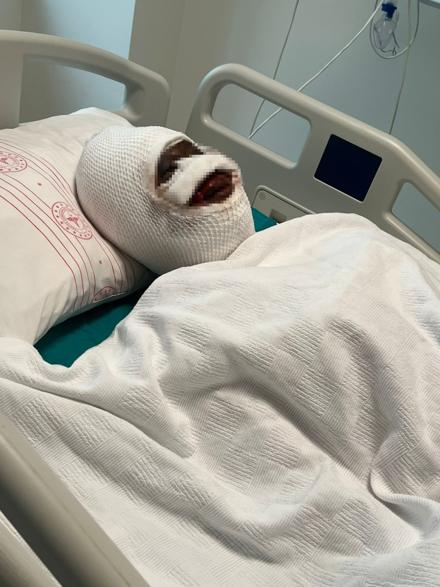 eski esini kezzapla agir yaralayan adam her seyi 19499307 453 m