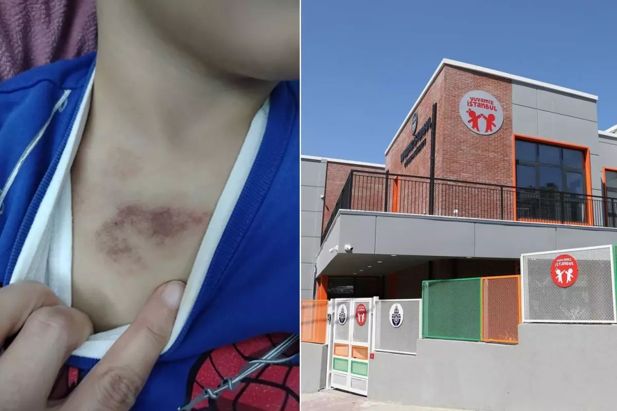 Kreşte taciz soruşturmasında mağdur çocuğun ifadesi: Arkadaşımı dövdü, elbisemi indirip çıplakken kameraya çekti