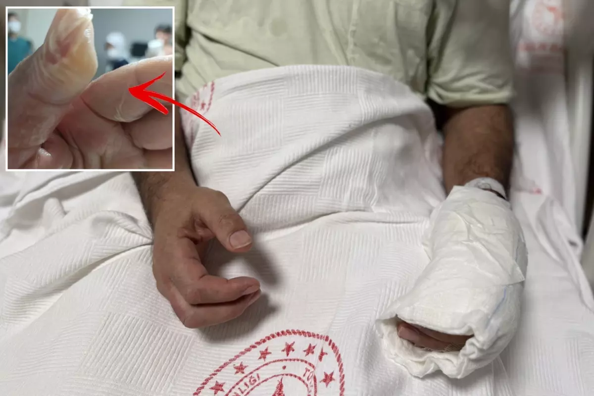 Herkesin evinde bulunan tehlike! Vücudunun yüzde 30'u yandı