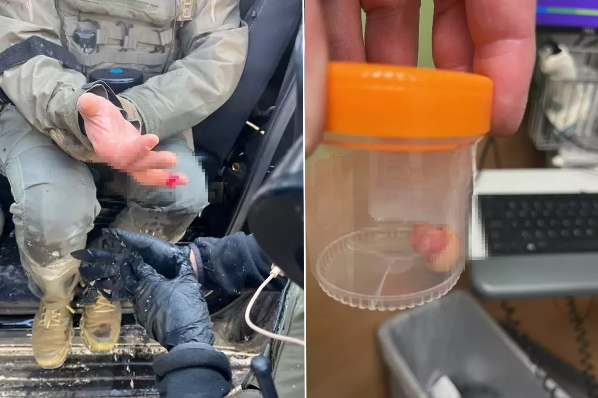 ICE karşıtı protestolarda şoke eden iddia: Görevlinin parmağını ısırarak kopardılar