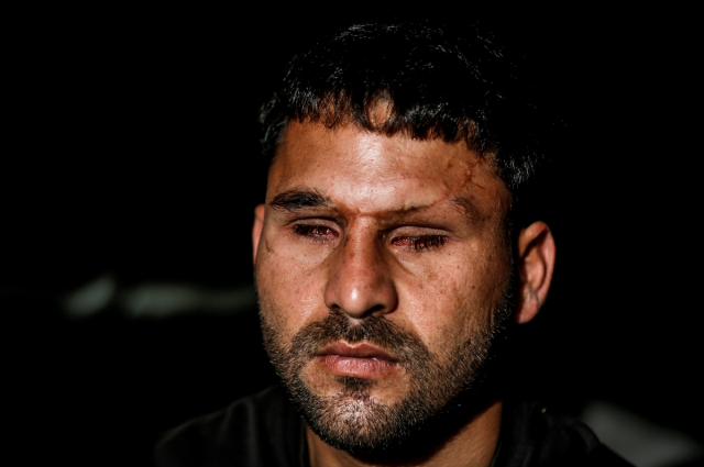 Injured twice in the war, lost his eyes