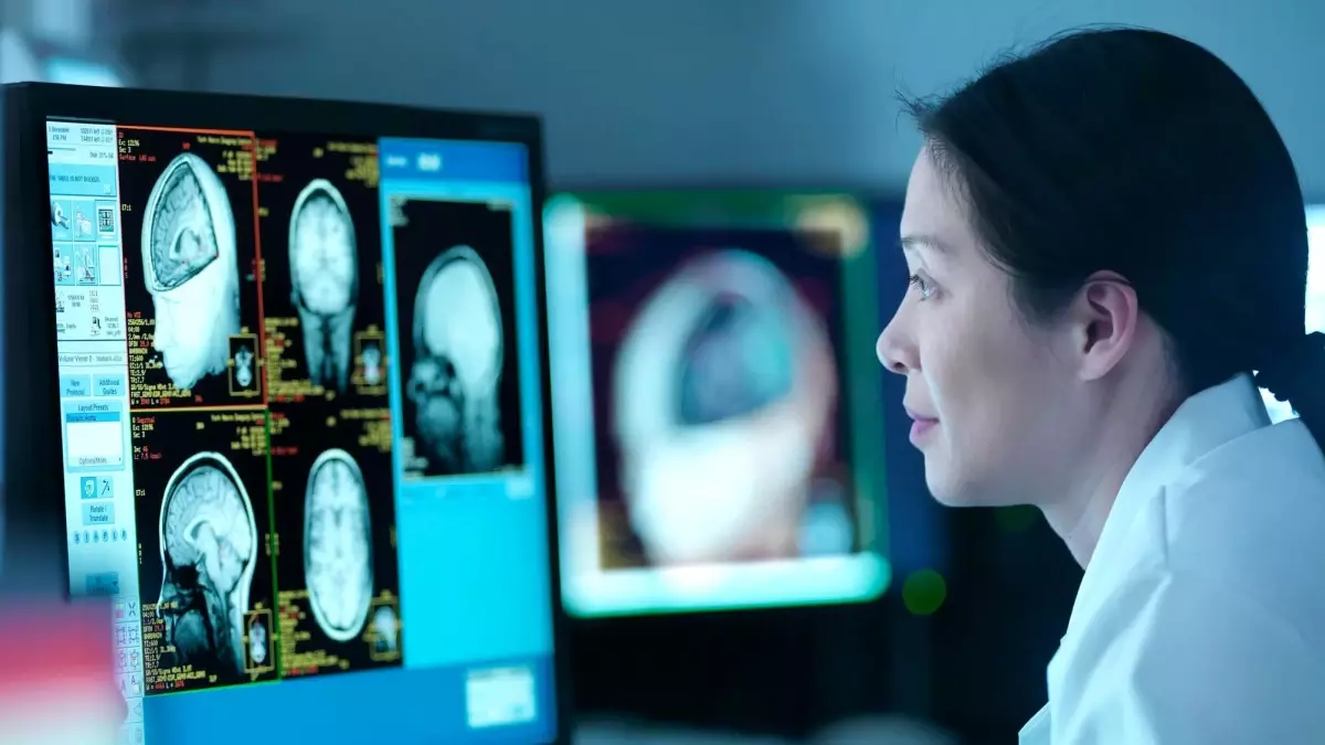 Menopoz beyni nasıl etkiliyor, demans ve Alzheimer riskini artırıyor mu?