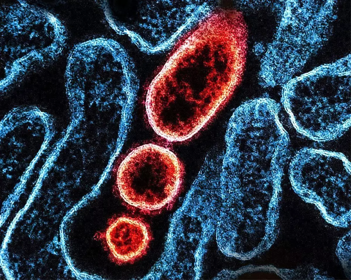 Nipah virüsü nedir, nasıl yayılıyor, ne kadar tehlikeli?