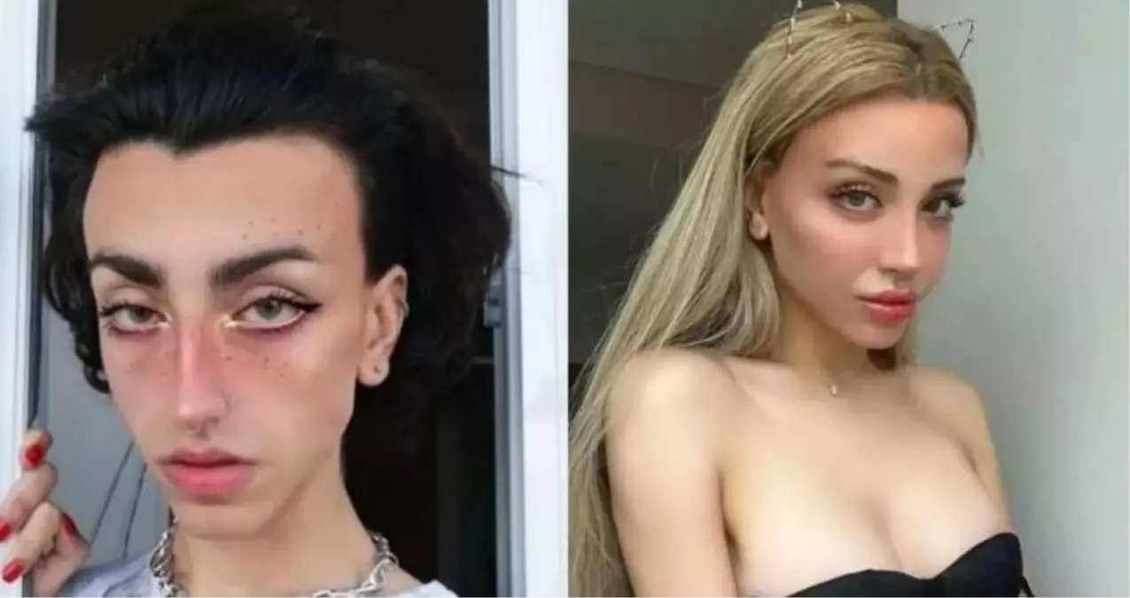 Mika Raun eski hali nasıl? Mika Raun'un eski cinsiyeti nedir, eski adı nedir?