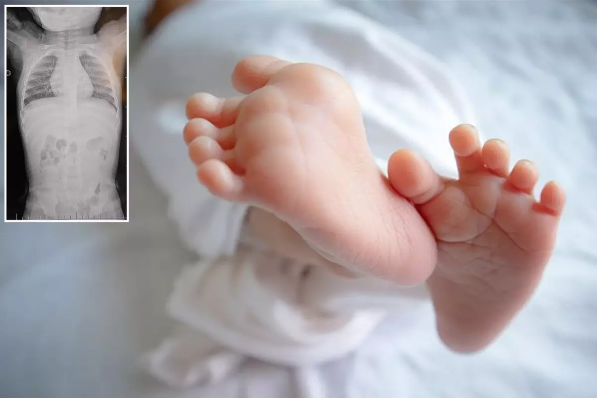 1 yaşındaki bebek sırtüstü yatırılınca hep ağladı! Gerçeği öğrenen aile şoke oldu